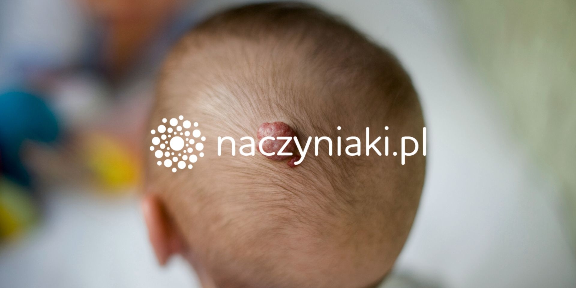 TG Coders - Pronect - Założyciel Naczyniaki.pl